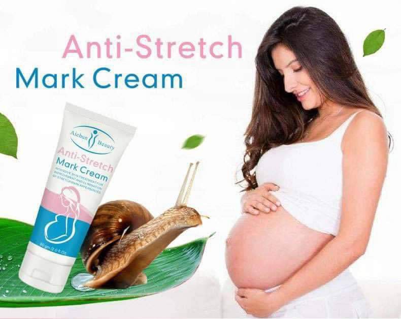 Anti Stretch Mark Cream প্রেগন্যান্সির ফাটা দাগ দূর করতে কার্যকারী